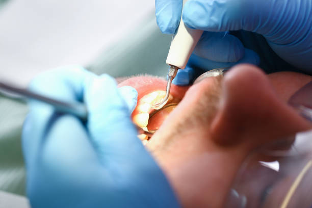 Best Emergency Dental Services for Seniors in Fairfax, VA